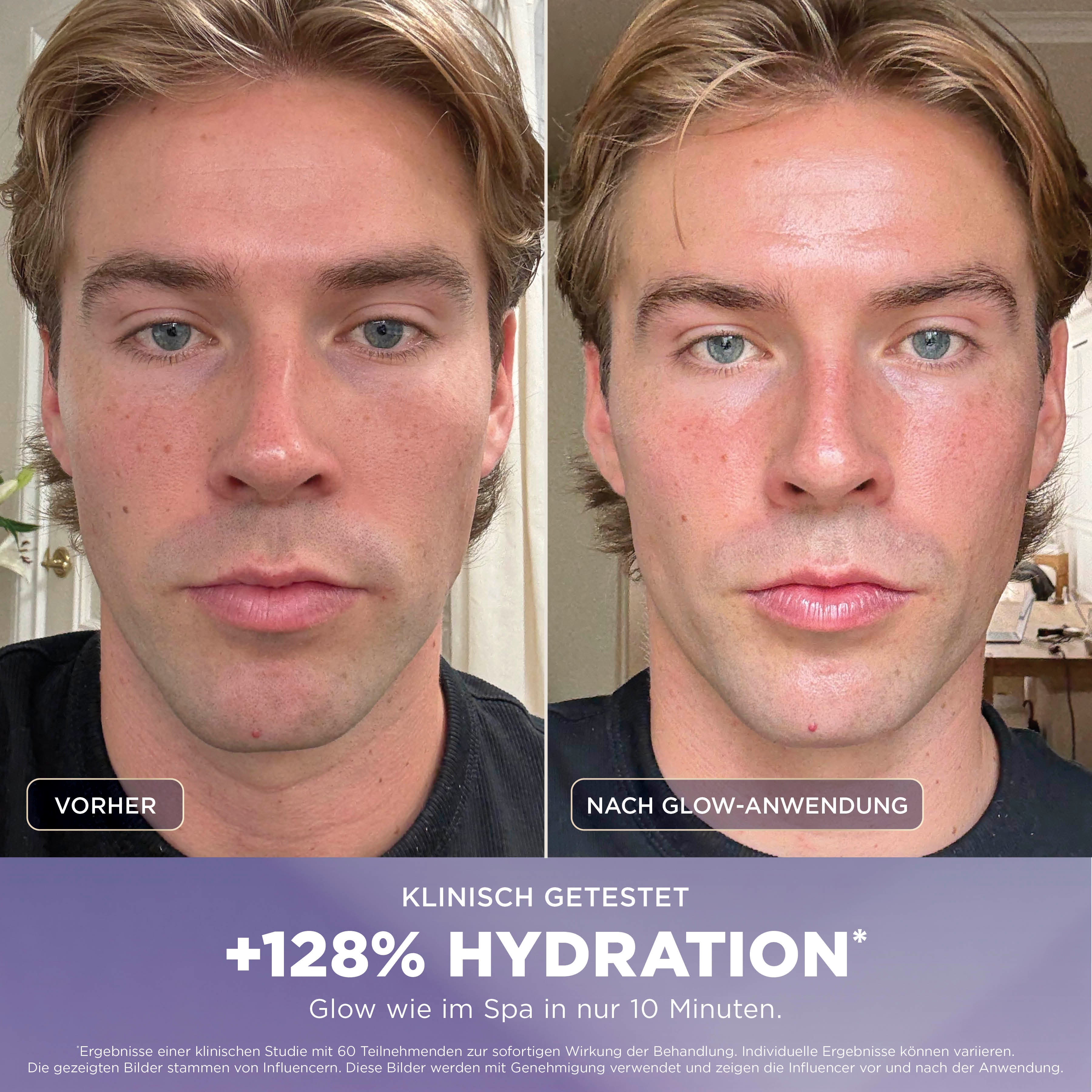Shark FH320CHPL FacialPro Glow